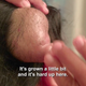 Image for article titled Bada Bing, Dr. Pimple Popper Meets Bada Boob